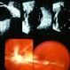 Pre-Retinal Fibrous Proliferative Membrane